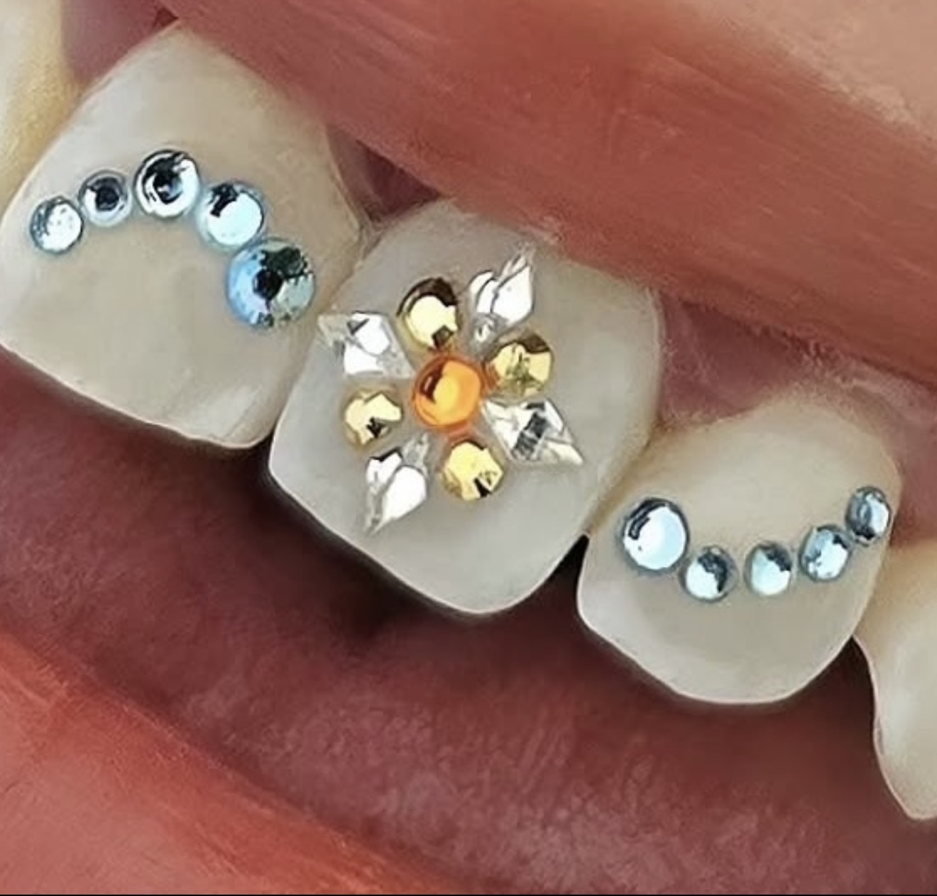 Strass dentaires Swarovski